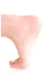 巻き爪の原因とは?